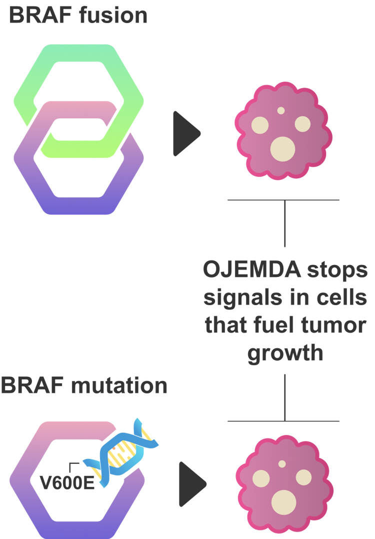 OJEMDA works to block tumor growth caused by an abnormal BRAF gene. OJEMDA stops signals in cells that fuel tumor growth